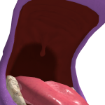 @error22513